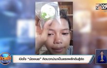 เปิดใจ “น้องเนย” คิดบวกนำมาเป็นแรงผลักดันสู้ต่อ