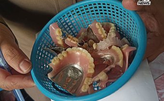 ไซเบอร์ทลายร้านฟันปลอมเถื่อน ขอนแก่น ลูกค้าติดเชื้อ