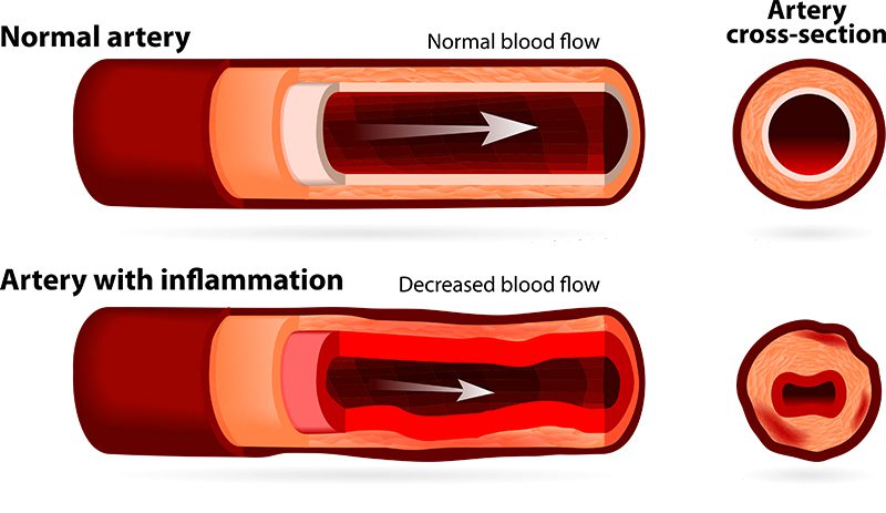 หลอดเลือด