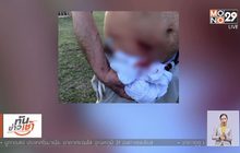 ​นักท่องเที่ยวถูกจิงโจ้ทำร้าย