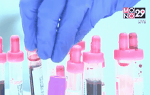 นักวิทยาศาสตร์ในสหรัฐฯ พบหนทางพิชิตเซลล์มะเร็ง