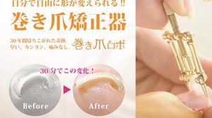 ญี่ปุ่นคิดได้! เครื่องซ่อมเล็บขบ หายขบภายใน 50 นาที