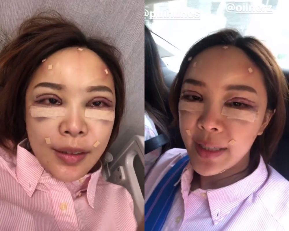 หญิงแย้บินไปศัลยกรรมที่เกาหลี