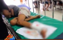 หวิดพิการ! ช่วยเด็กหญิงข้อเท้าติดล้อ จยย.