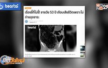 ชายวัย 53 ปี เกือบเสียชีวิตเพราะไม่ถ่ายอุจจาระ