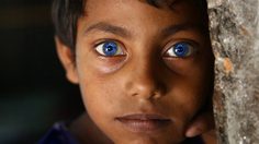 เด็กชายบังคลาเทศ ผู้มีดวงตาเป็นสีฟ้าเหมือนไพลิน สวยมากๆ