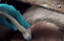 พบสัญญาณชีพจรการตั้งท้อง “หลินฮุ่ย”