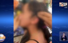 นักเรียนเข้าค่ายกลับมาบ้านเนื้อตัวบอบช้ำ อ้างถูกครูทำร้าย