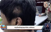 หนุ่มโชคร้ายถูกรุมทำร้าย แต่ผิดคน