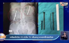 เครียดโควิด-19 ตาวัย75 กลืนตะปู-ลวดเหล็กลงท้อง