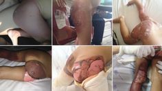 อันตรายใกล้ตัวลูก Shower in hell มหันตภัยจาก เครื่องทำน้ำอุ่น โรงแรม