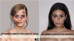 สาวฮอลลีวู้ด เผยภาพ โดนซ้อม จนหน้าน่วม ในโปรเจค ยุติความรุนแรงในผู้หญิง