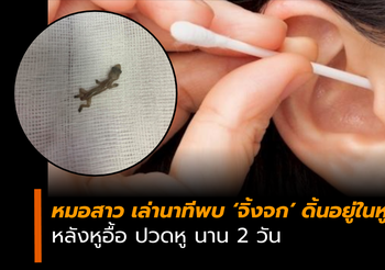 หมอสาว โพสต์เล่า คนไข้หูอื้อ ปวดหู นาน 2 วัน พบจิ้งจกดิ้นอยู่ในรูหู