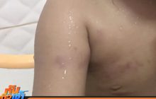 แม่เด็ก 2 ขวบยืนยันเอาเรื่องครูผู้ช่วย-โรงเรียนให้ถึงที่สุด