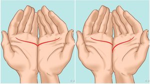 อยากรู้เนื้อคู่เป็นแบบไหน? เส้นหัวใจ บอกเราได้นะ มีวิธีเช็คง๊ายง่าย