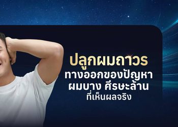 ปลูกผมถาวรคืออะไร? รวมทุกเรื่องที่ควรรู้ก่อนตัดสินใจปลูกผม