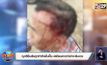 ญาติยืนยันถูกทำร้ายในปั๊ม-เสมียนคาดว่าน่าจะล้มเอง
