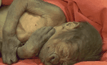 ผ่าคลอดลูกลิงเกิดใหม่ในอังกฤษ