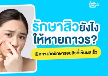 รักษาสิวยังไงให้หาย ลดการเกิดสิวอักเสบ พร้อมวิธีฟื้นฟูรอยสิว