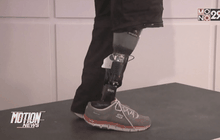 นักวิจัยออสเตรียประดิษฐ์ขาเทียมให้ความรู้สึก