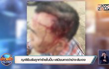 ญาติยืนยันถูกทำร้ายในปั๊ม-เสมียนคาดว่าน่าจะล้มเอง