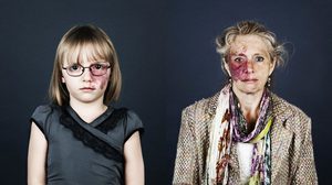 ภาพถ่ายของคนมีปาน ที่อาจทำให้คุณมองเห็น ความงามที่แท้จริง เปลี่ยนไป!!