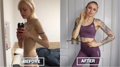 สวยกว่าเห็นๆ สาวคลั่งผอม ฮึดสู้ความตาย ฟิตร่างกายจนได้เป็นเทรนเนอร์ฟิตเนส