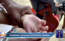 พี่ชายขี้สงสัย นำเจลแอลกอฮอล์ทามือน้อง ก่อนจุดไฟ