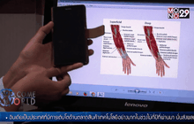 ความเจ็บป่วยจากอุปกรณ์อิเล็กทรอนิกส์