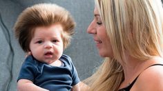 น่ารักสุดๆ! หนูน้อยวัยเพียง 8 สัปดาห์ ผมดกหนา จนทำให้เราต้องอิจฉา