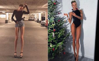 Ia Ostergren สาวยาขาวมาก ถูกล้อประหลาดตอนเด็ก สู่นางแบบสายสปอร์ตผู้โด่งดัง