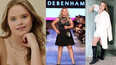 แตกต่างแต่เท่าเทียม สาวดาวน์ซินโดรม เดินตามฝัน เซ็นสัญญาโมเดลลิ่ง ถึง 5 ค่าย