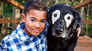 แล้วโลกก็เปลี่ยนไป!! หนูน้อยเคยเกลียดหน้าตัวเอง จนได้เจอหมาที่ป่วยเป็น โรคด่างขาว เหมือนกัน