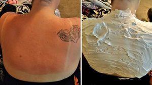 ความรู้ใหม่! สาวอเมริกันค้นพบ วิธีแก้ผิวไหม้แดด ด้วยครีมโกนหนวดของสามี