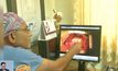 แพทย์อินเดียปลูกถ่าย “หัวใจดวงที่ 2” ให้ผู้ป่วย