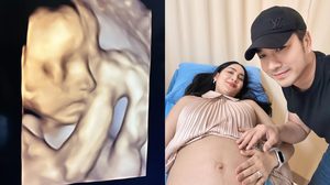 “ครูก้อย” อัปเดตครรภ์ 26 สัปดาห์ ตรวจเบาหวานตั้งครรภ์ผ่านฉลุย! “เจมส์” ดูแลไม่ห่าง