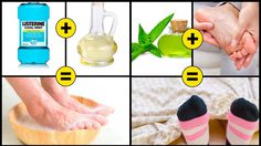 10 สูตรแก้ส้นเท้าแตก แบบบ้านๆ เน้นประหยัด แต่ได้ผลชัวร์!!!