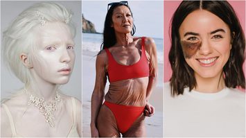 7 ผู้หญิงสตรองเผชิญกับโรคหายาก พลิกปมดอยเป็นความแกร่ง ส่งต่อแรงบันดาลใจ