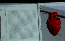 แถบชีวภาพสำหรับอุดรูรั่วหัวใจ