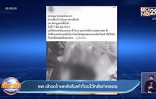 รพ.เข้าขอโทษหลังลืมผ้าก๊อซไว้หลังทำคลอด