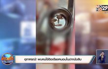 อุทาหรณ์ ! พบคนไข้ติดเตียงหนอนในปากนับสิบ