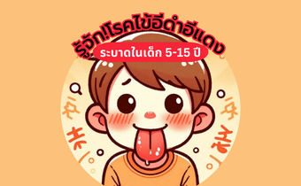 รู้จัก! โรคไข้อีดำอีแดง ระบาดในเด็ก พร้อมบอกวิธีป้องกันและรักษา