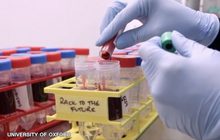 สถานการณ์ไวรัสโควิด-19 ในต่างประเทศ 19-09-63