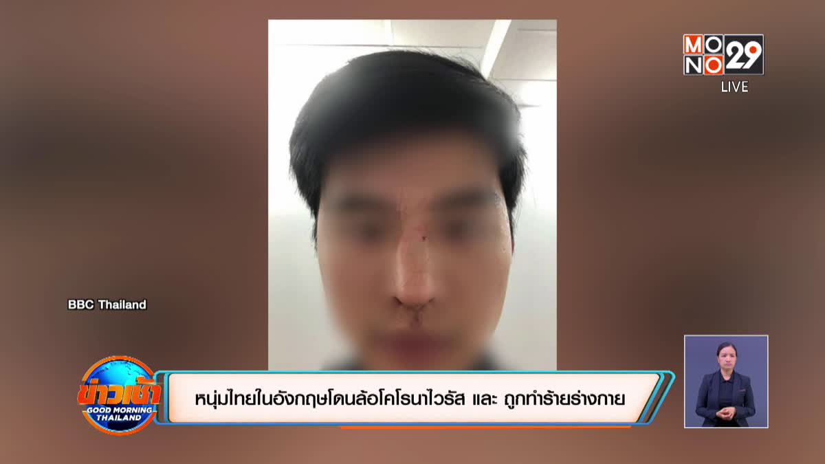 หนุ่มไทยในอังกฤษโดนล้อโคโรนาไวรัส แถมถูกชกจมูกหัก