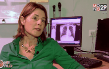 พบการติดเชื้อโรคระบาดในศตวรรษที่ 19 อีกครั้ง