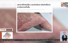 Mthai Update 10/04/2018