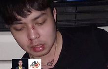 หลาน “สุเทพ” ขับเก๋งชนท้ายแท็กซี่ ก่อนถูกการ์ดรุมยำซ้ำ