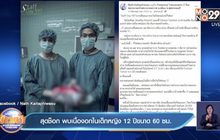 สุดช็อก พบเนื้องอกในเด็กหญิง 12 ปีขนาด 60 ซม.