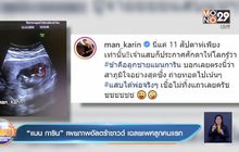 “แมน การิน” เผยภาพอัลตร้าซาวด์ เฉลยเพศลูกคนแรก