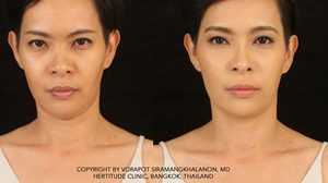 อะไร ทำให้ ผู้หญิงคนนี้ “เปลี่ยนไป” ใน 1 ชั่วโมง